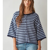 Striped Cardigan